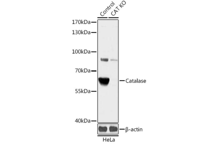 Western Blot - Anti-Catalase Antibody (A92991) - Antibodies.com