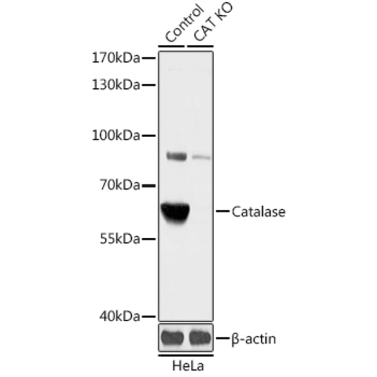 Western Blot - Anti-Catalase Antibody (A92991) - Antibodies.com