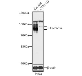 Western Blot - Anti-Cortactin Antibody (A92995) - Antibodies.com