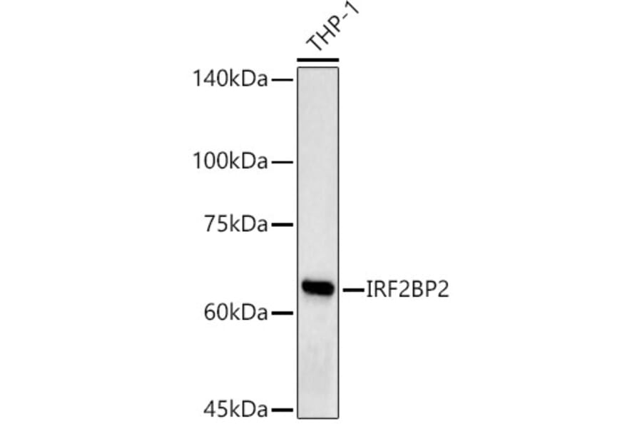 Western Blot - Anti-IRF2BP2 Antibody (A92996) - Antibodies.com