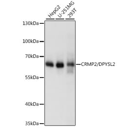 Western Blot - Anti-CRMP2 Antibody (A92997) - Antibodies.com