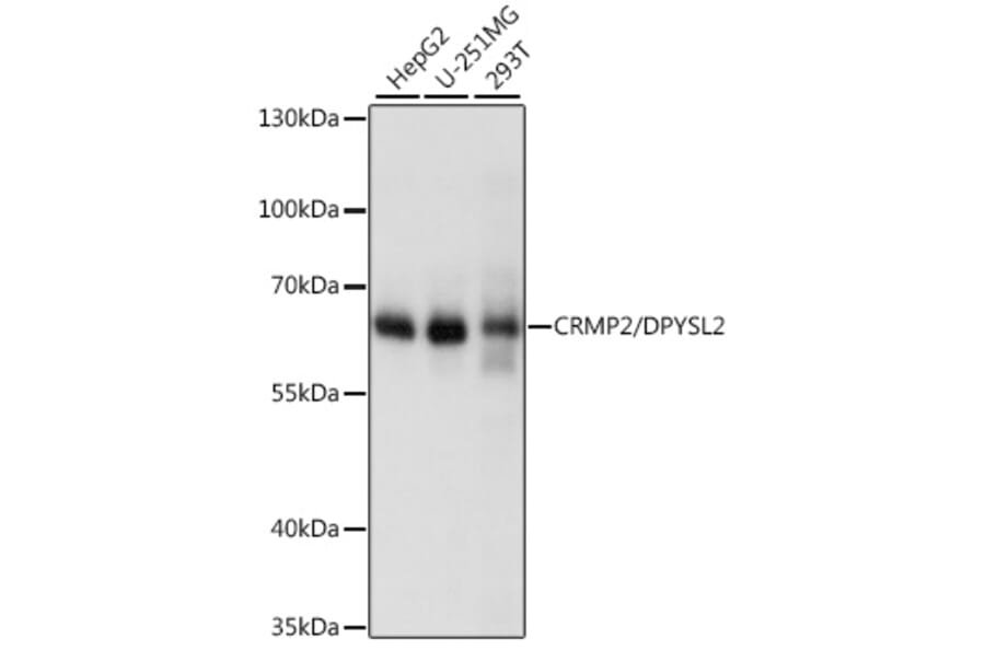 Western Blot - Anti-CRMP2 Antibody (A92997) - Antibodies.com