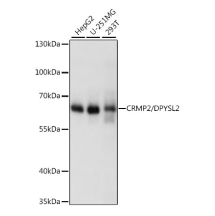 Western Blot - Anti-CRMP2 Antibody (A92997) - Antibodies.com