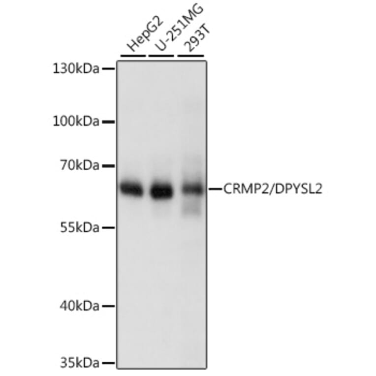 Western Blot - Anti-CRMP2 Antibody (A92997) - Antibodies.com