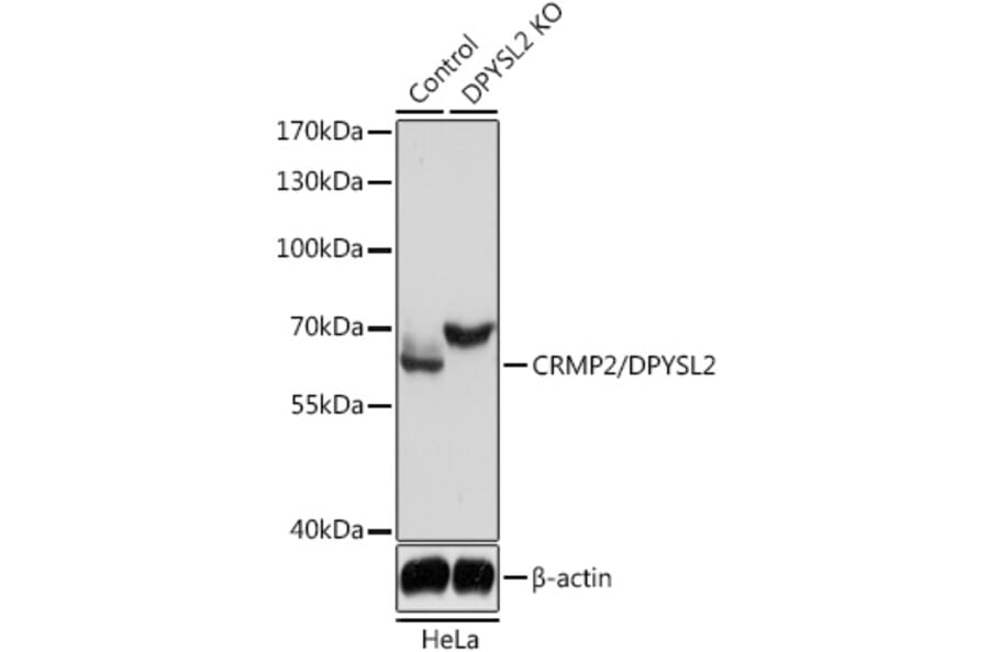 Western Blot - Anti-CRMP2 Antibody (A92997) - Antibodies.com