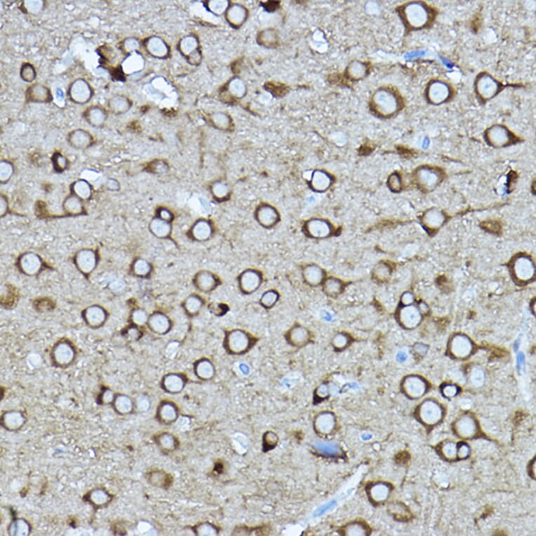 Immunohistochemistry - Anti-CRMP2 Antibody (A92997) - Antibodies.com