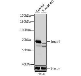 Western Blot - Anti-Smad4 Antibody (A92998) - Antibodies.com