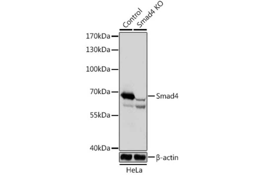 Western Blot - Anti-Smad4 Antibody (A92998) - Antibodies.com
