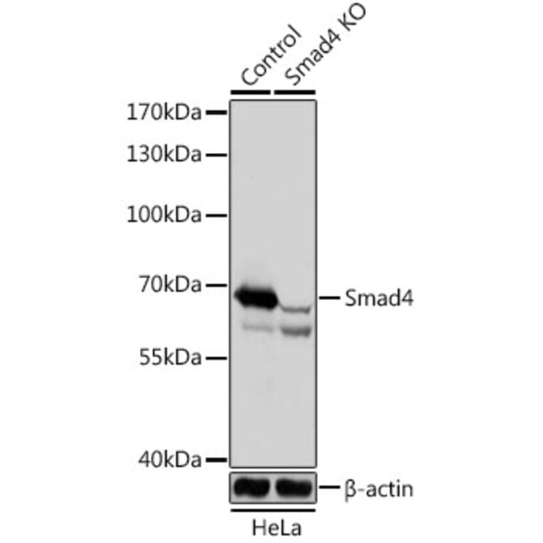 Western Blot - Anti-Smad4 Antibody (A92998) - Antibodies.com