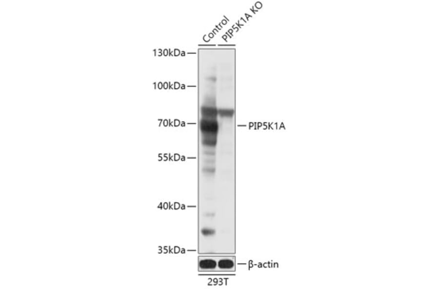 Western Blot - Anti-PIP5K1 alpha / PIP5K1A Antibody (A92999) - Antibodies.com