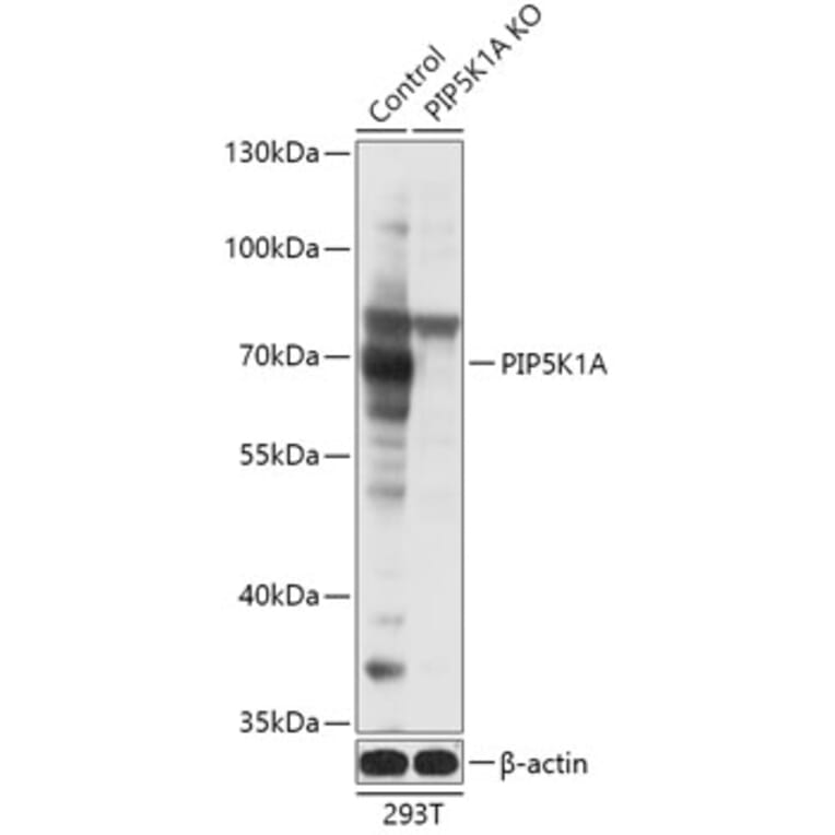 Western Blot - Anti-PIP5K1 alpha / PIP5K1A Antibody (A92999) - Antibodies.com