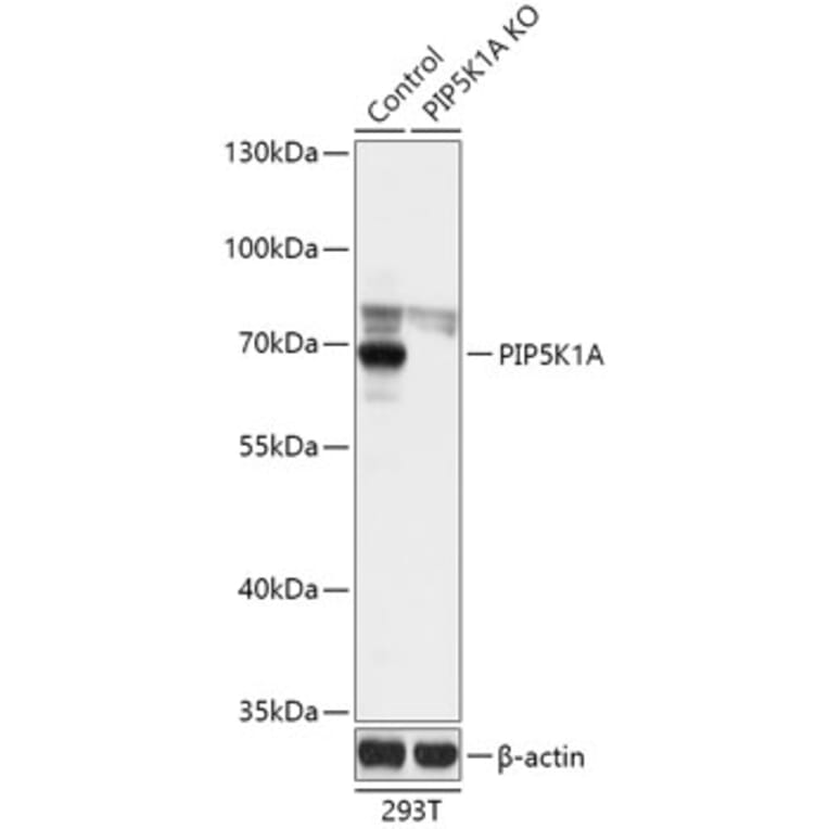 Western Blot - Anti-PIP5K1 alpha / PIP5K1A Antibody (A93000) - Antibodies.com