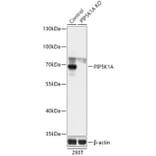 Western Blot - Anti-PIP5K1 alpha / PIP5K1A Antibody (A93000) - Antibodies.com