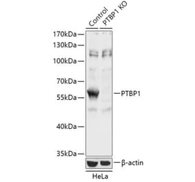 Western Blot - Anti-PTBP1 Antibody (A93001) - Antibodies.com