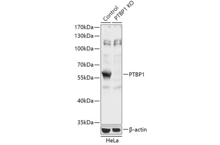 Western Blot - Anti-PTBP1 Antibody (A93001) - Antibodies.com