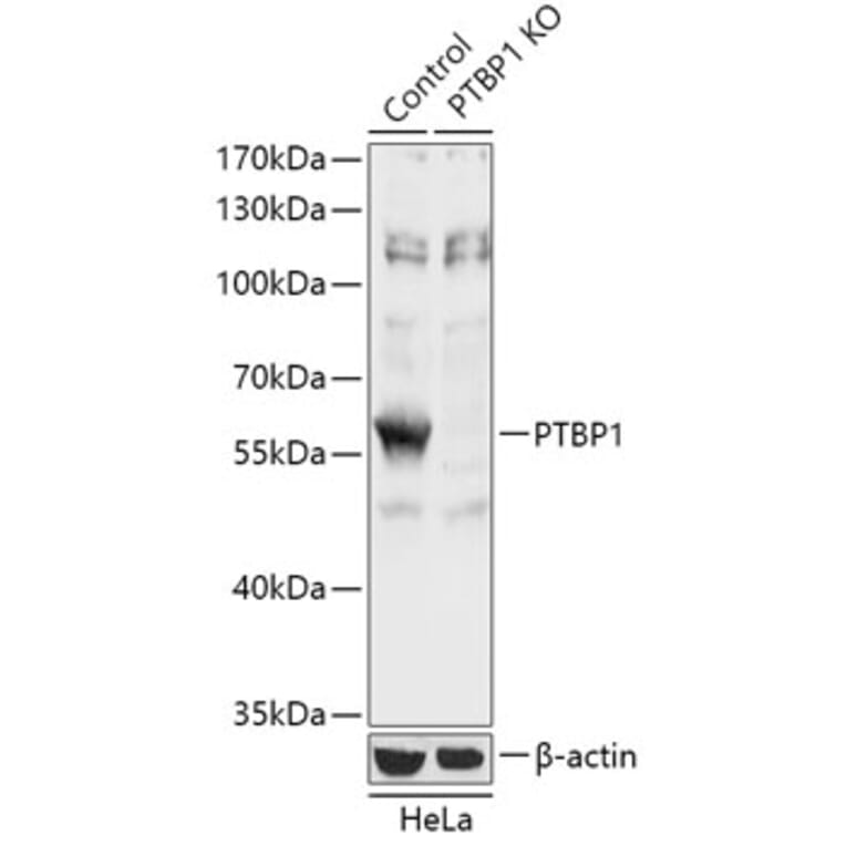 Western Blot - Anti-PTBP1 Antibody (A93001) - Antibodies.com