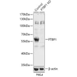 Western Blot - Anti-PTBP1 Antibody (A93001) - Antibodies.com
