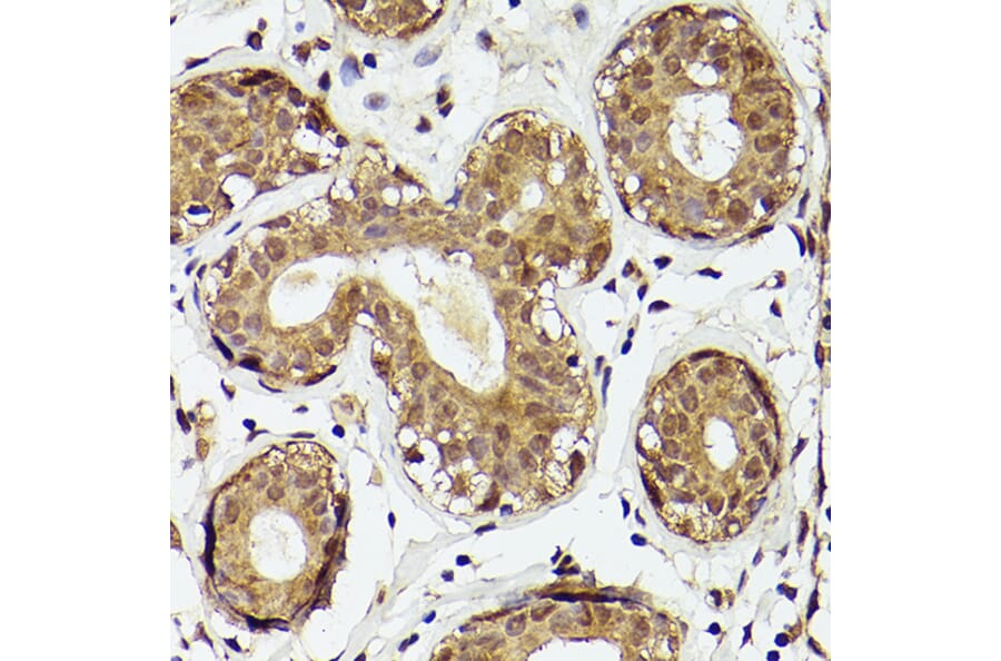 Immunohistochemistry - Anti-PTEN Antibody (A93003) - Antibodies.com