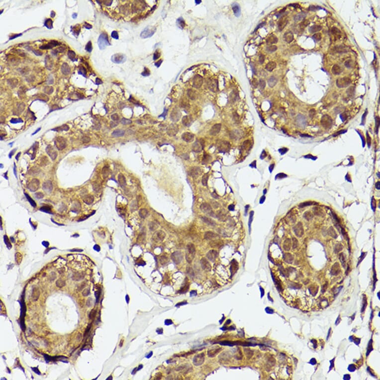 Immunohistochemistry - Anti-PTEN Antibody (A93003) - Antibodies.com