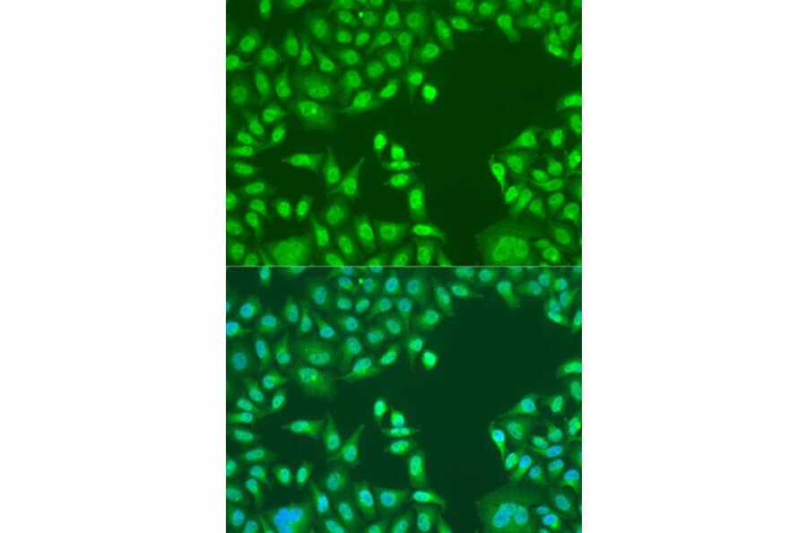 Immunofluorescence - Anti-PTEN Antibody (A93003) - Antibodies.com