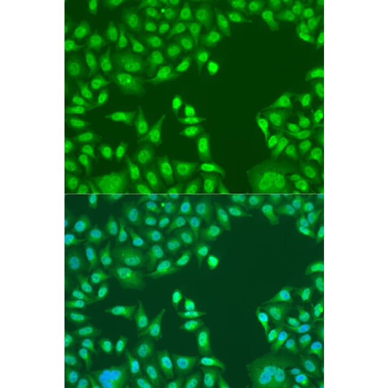 Immunofluorescence - Anti-PTEN Antibody (A93003) - Antibodies.com