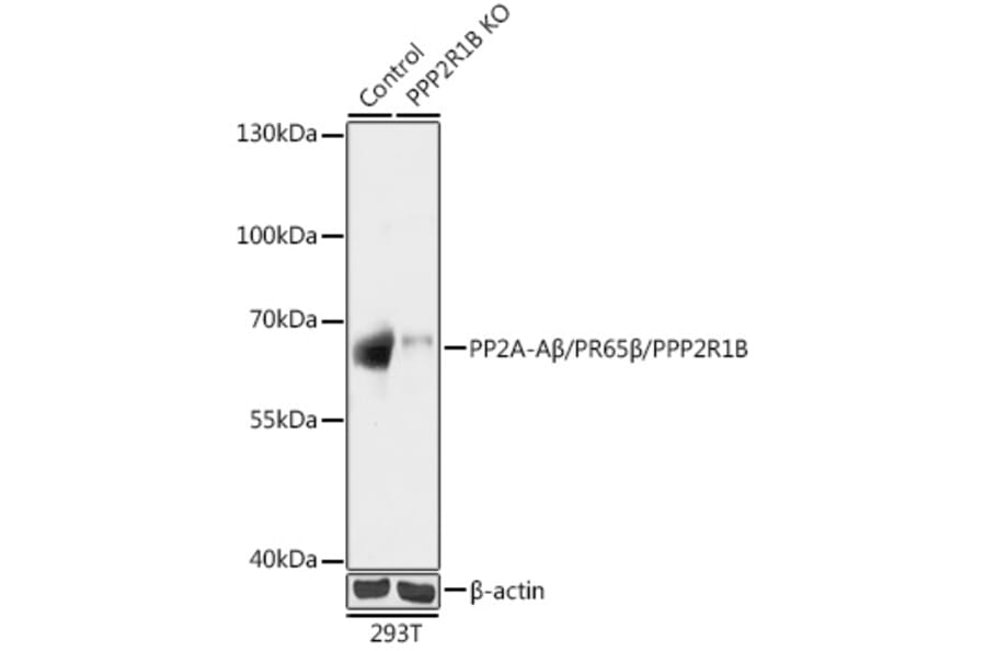 Western Blot - Anti-PPP2R1B Antibody (A93004) - Antibodies.com