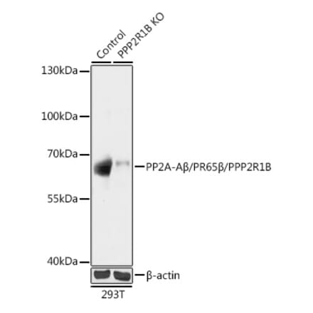 Western Blot - Anti-PPP2R1B Antibody (A93004) - Antibodies.com