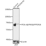 Western Blot - Anti-PPP2R1B Antibody (A93004) - Antibodies.com