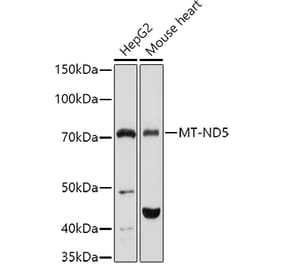 Western Blot - Anti-MT-ND5 Antibody (A93006) - Antibodies.com