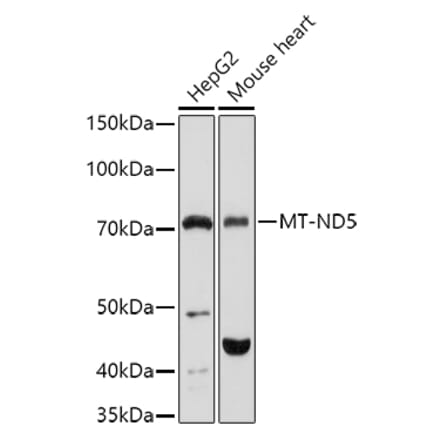 Western Blot - Anti-MT-ND5 Antibody (A93006) - Antibodies.com