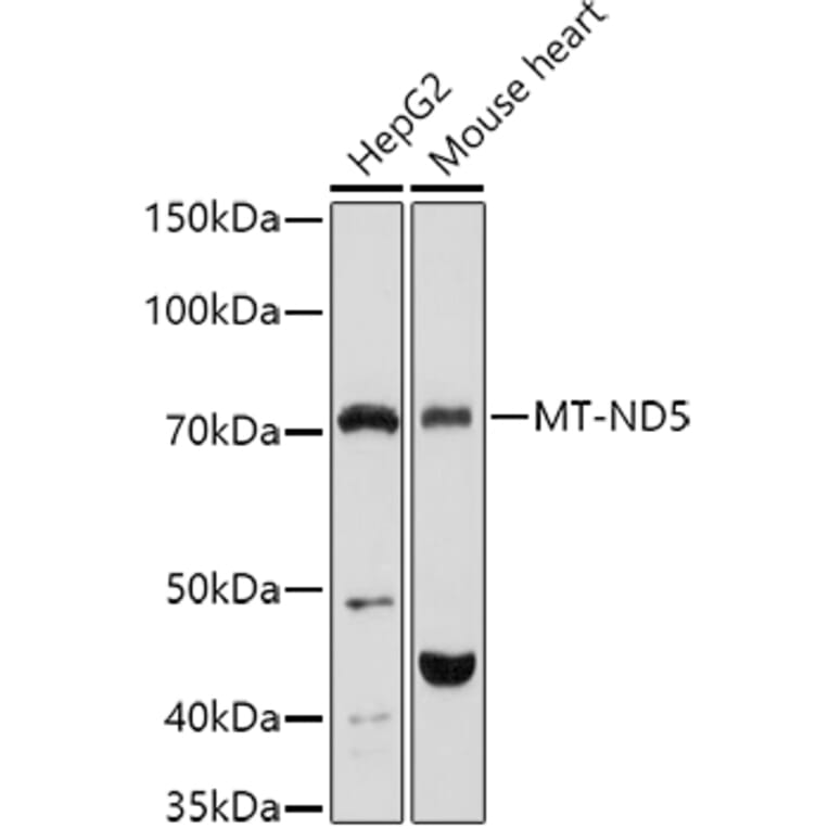 Western Blot - Anti-MT-ND5 Antibody (A93006) - Antibodies.com