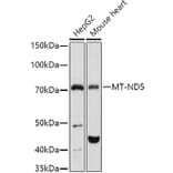 Western Blot - Anti-MT-ND5 Antibody (A93006) - Antibodies.com