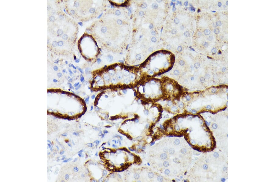 Immunohistochemistry - Anti-MT-ND5 Antibody (A93006) - Antibodies.com