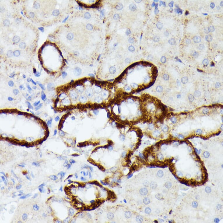 Immunohistochemistry - Anti-MT-ND5 Antibody (A93006) - Antibodies.com