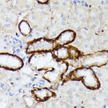 Immunohistochemistry - Anti-MT-ND5 Antibody (A93006) - Antibodies.com