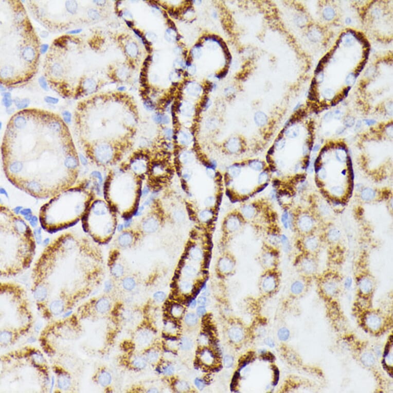 Immunohistochemistry - Anti-MT-ND5 Antibody (A93006) - Antibodies.com