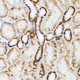 Immunohistochemistry - Anti-MT-ND5 Antibody (A93006) - Antibodies.com