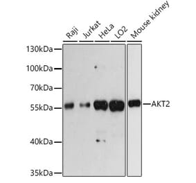 Western Blot - Anti-AKT2 Antibody (A93007) - Antibodies.com