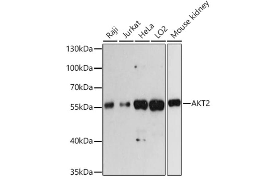 Western Blot - Anti-AKT2 Antibody (A93007) - Antibodies.com