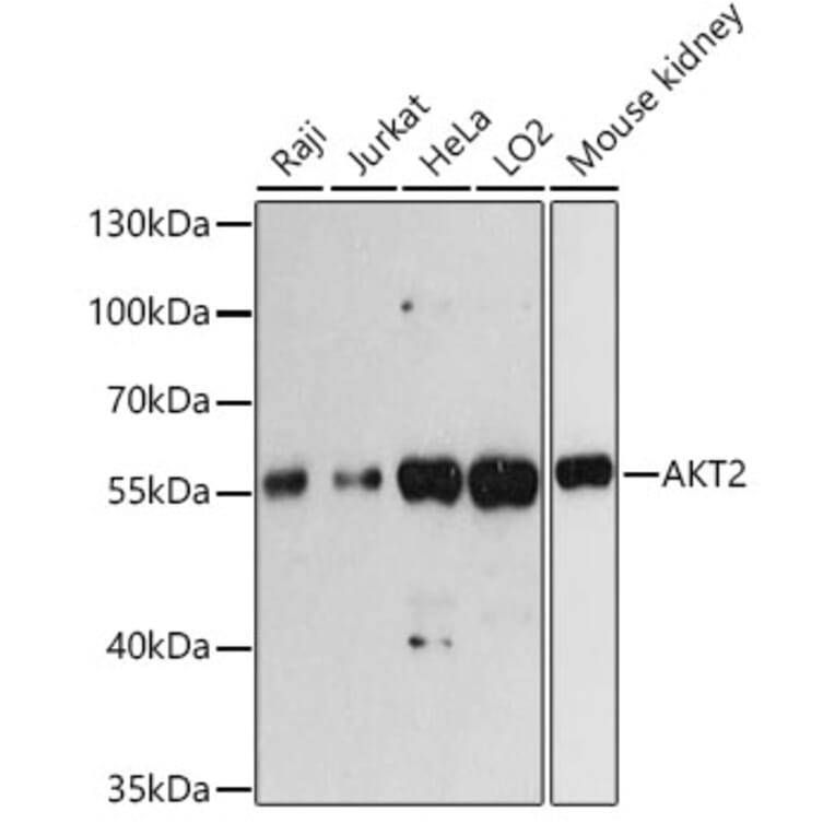 Western Blot - Anti-AKT2 Antibody (A93007) - Antibodies.com