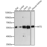 Western Blot - Anti-AKT2 Antibody (A93007) - Antibodies.com