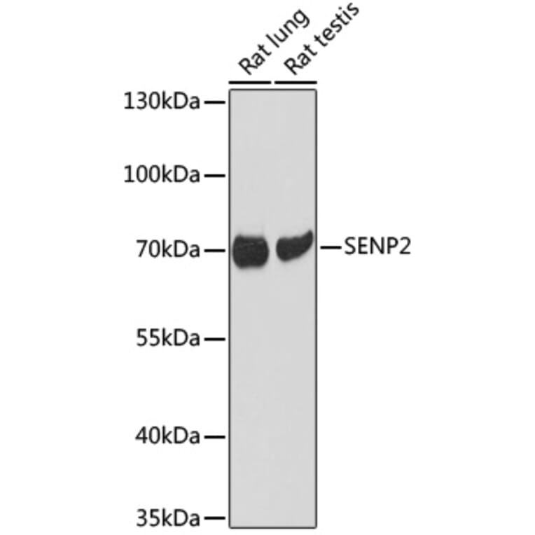 Western Blot - Anti-SENP2 Antibody (A93008) - Antibodies.com