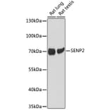 Western Blot - Anti-SENP2 Antibody (A93008) - Antibodies.com