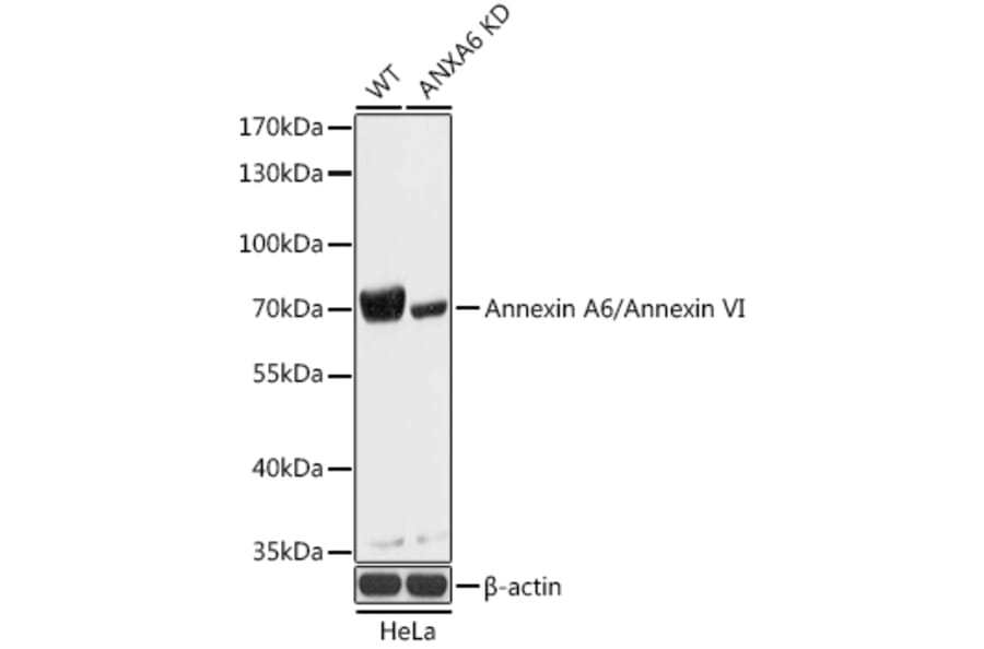 Western Blot - Anti-Annexin-6/ANXA6 Antibody (A93010) - Antibodies.com