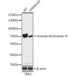 Western Blot - Anti-Annexin-6/ANXA6 Antibody (A93010) - Antibodies.com