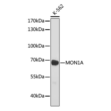 Western Blot - Anti-MON1A Antibody (A93011) - Antibodies.com