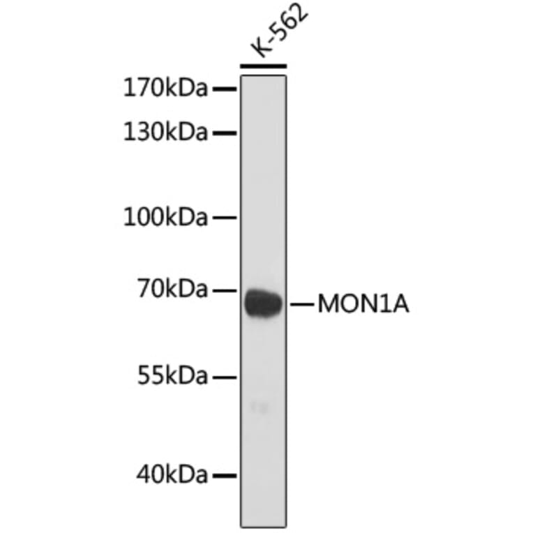 Western Blot - Anti-MON1A Antibody (A93011) - Antibodies.com