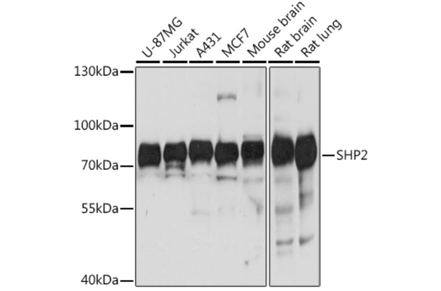 Western Blot - Anti-SHP2 Antibody (A93012) - Antibodies.com