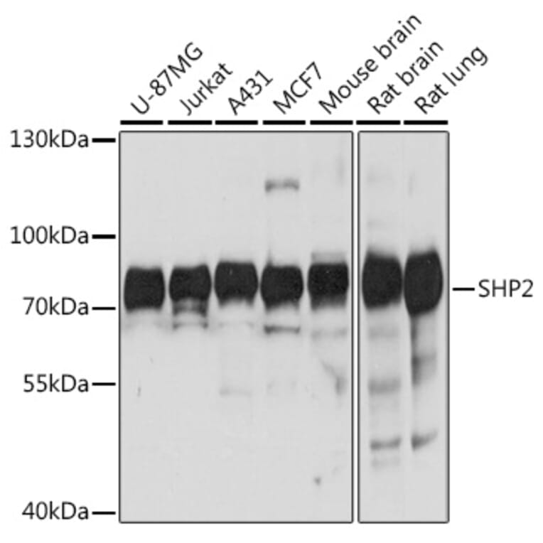 Western Blot - Anti-SHP2 Antibody (A93012) - Antibodies.com