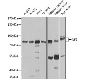 Western Blot - Anti-NF2 / Merlin Antibody (A93014) - Antibodies.com